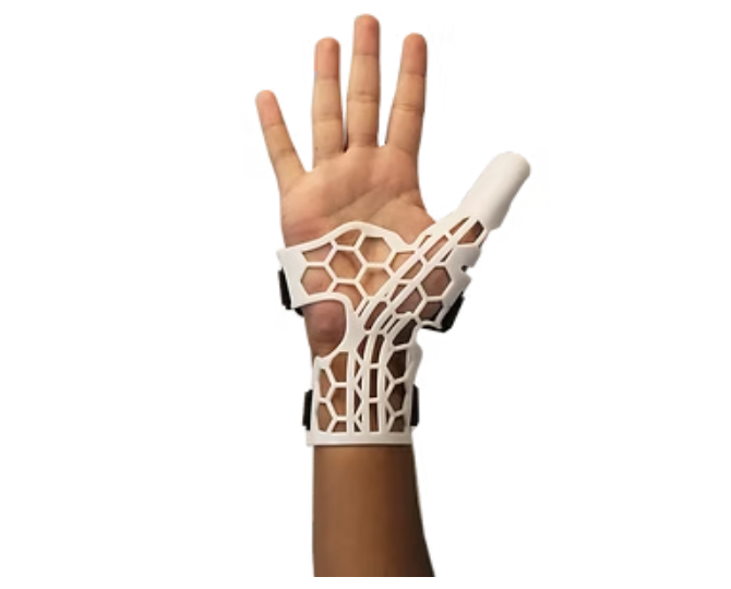 Design of Upper and Lower Limb Orthoses
