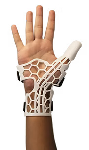 Design of Upper and Lower Limb Orthoses