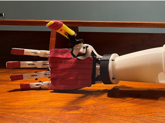 Development of Transradial Prosthetic Hand